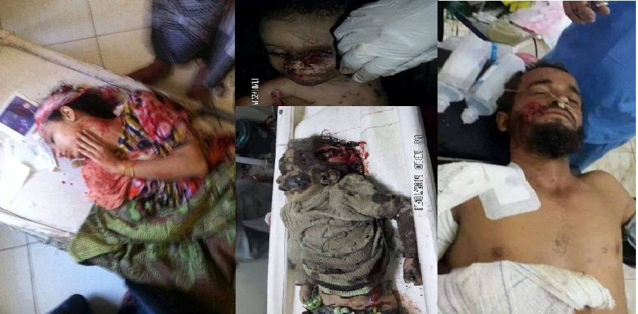 وكالة فرنس برس : مقتل امرأة حامل وابنتيها في قصف للجيش جنوب اليمن